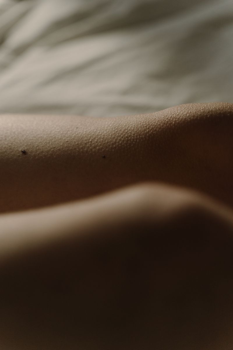 Detailed close-up of human skin showing natural texture and small moles, as seen under magnification